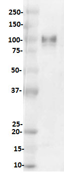 Western blot - Anti-CD276 antibody [SP265] - C-terminal (AB227679), expandable thumbnail