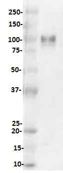 Western blot - Anti-CD276 antibody [SP265] - C-terminal (AB227679)