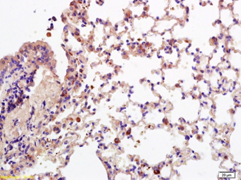 Immunohistochemistry (Formalin/PFA-fixed paraffin-embedded sections) - Anti-CD28 antibody (AB203084), expandable thumbnail