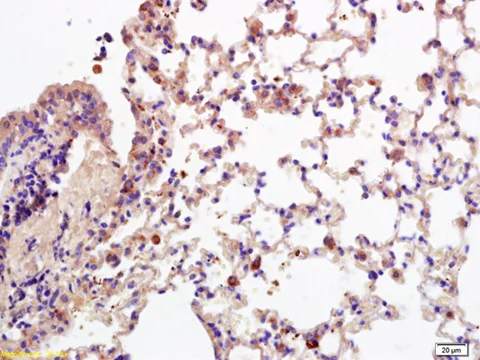 Immunohistochemistry (Formalin/PFA-fixed paraffin-embedded sections) - Anti-CD28 antibody (AB203084)