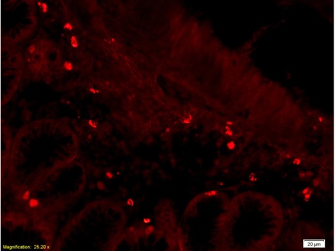 Immunohistochemistry (Formalin/PFA-fixed paraffin-embedded sections) - Anti-CD28 antibody (AB203084), expandable thumbnail