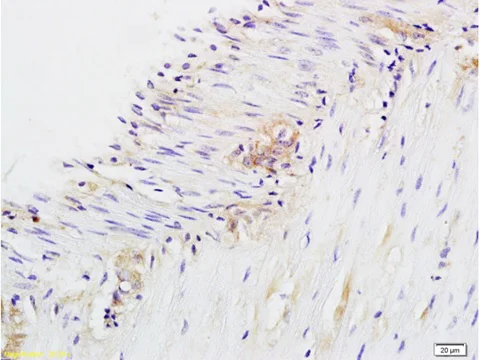 Immunohistochemistry (Formalin/PFA-fixed paraffin-embedded sections) - Anti-CD28 antibody (AB203084)