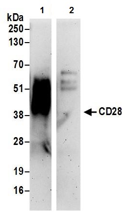 Immunoprecipitation - Anti-CD28 antibody (AB245327)