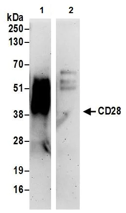 Immunoprecipitation - Anti-CD28 antibody (AB245327)
