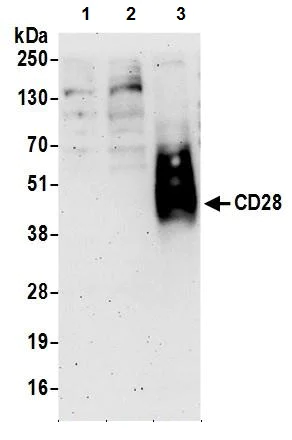 Western blot - Anti-CD28 antibody (AB245327)