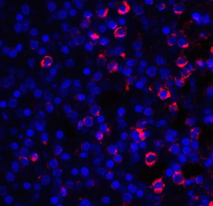 Immunocytochemistry/ Immunofluorescence - Anti-CD28 antibody (AB254580)