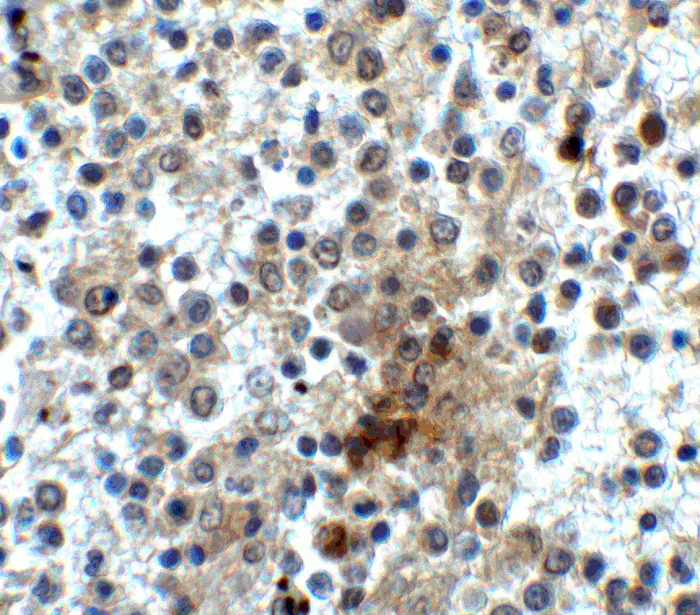 Immunohistochemistry (Formalin/PFA-fixed paraffin-embedded sections) - Anti-CD28 antibody (AB254580)