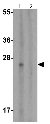 Western blot - Anti-CD28 antibody (AB254580)