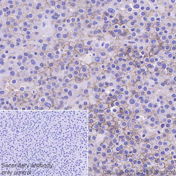 Immunohistochemistry (Formalin/PFA-fixed paraffin-embedded sections) - Anti-CD28 antibody [EPR22076] (ab243228), expandable thumbnail
