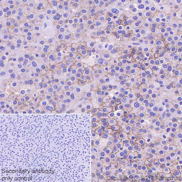 Immunohistochemistry (Formalin/PFA-fixed paraffin-embedded sections) - Anti-CD28 antibody [EPR22076] - BSA and Azide free (AB243557)