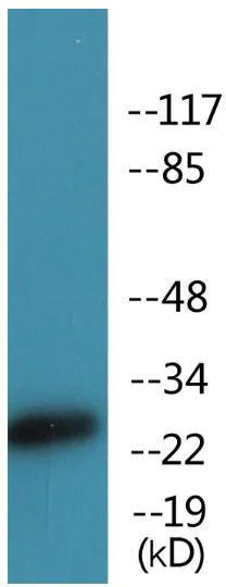 Western blot - Anti-CD28 (phospho Y218) antibody (AB138404)