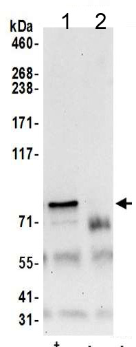 Immunoprecipitation - Anti-CD2AP antibody (AB205017)
