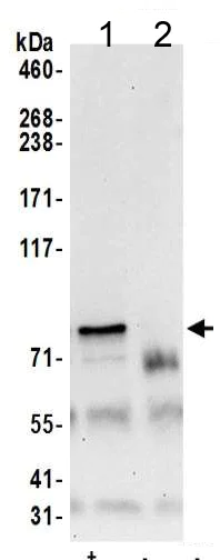 Immunoprecipitation - Anti-CD2AP antibody (AB205017)
