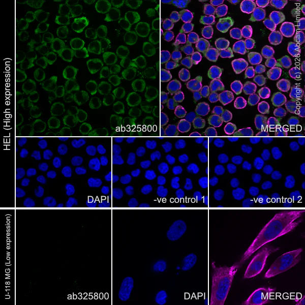 Immunocytochemistry/ Immunofluorescence - Anti-CD2AP antibody [EPR30265-529] (AB325800)