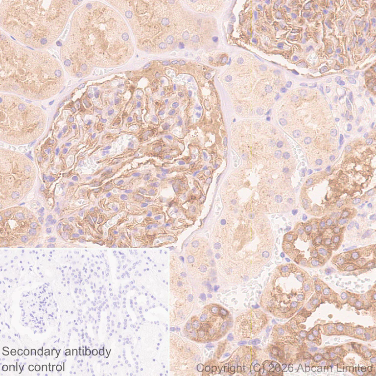Immunohistochemistry (Formalin/PFA-fixed paraffin-embedded sections) - Anti-CD2AP antibody [EPR30265-529] (AB325800)