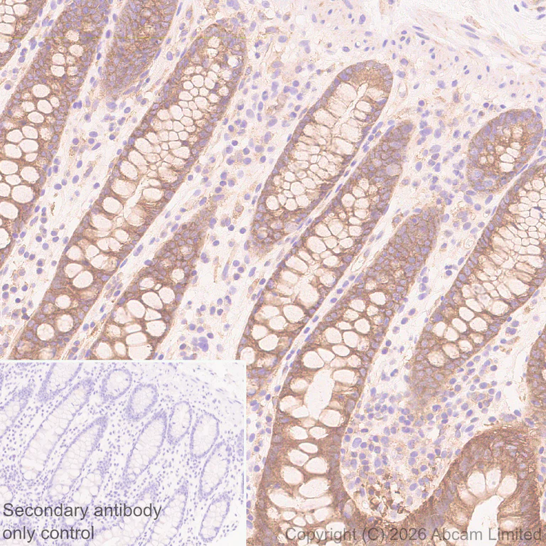 Immunohistochemistry (Formalin/PFA-fixed paraffin-embedded sections) - Anti-CD2AP antibody [EPR30265-529] (AB325800)