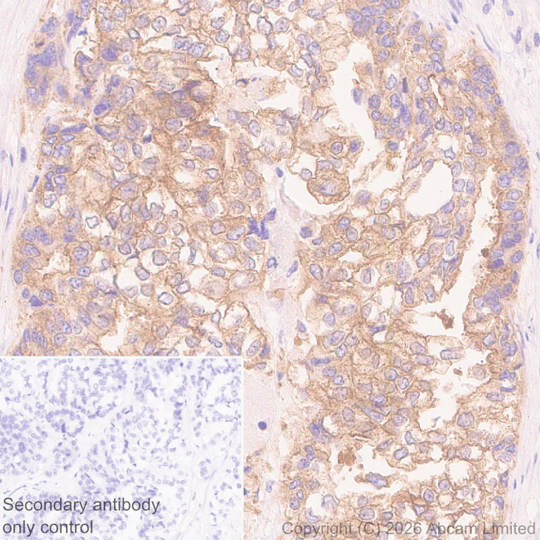 Immunohistochemistry (Formalin/PFA-fixed paraffin-embedded sections) - Anti-CD2AP antibody [EPR30265-529] (AB325800)