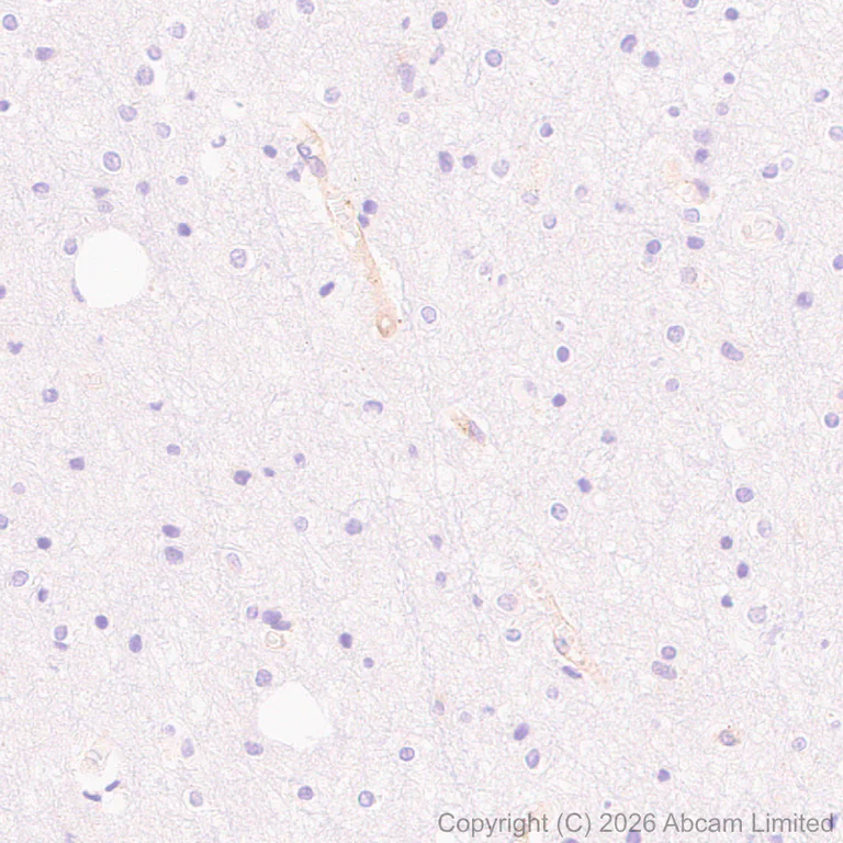 Immunohistochemistry (Formalin/PFA-fixed paraffin-embedded sections) - Anti-CD2AP antibody [EPR30265-529] (AB325800)