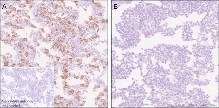 Immunohistochemistry (Formalin/PFA-fixed paraffin-embedded sections) - Anti-CD2AP antibody [EPR30265-529] (AB325800)
