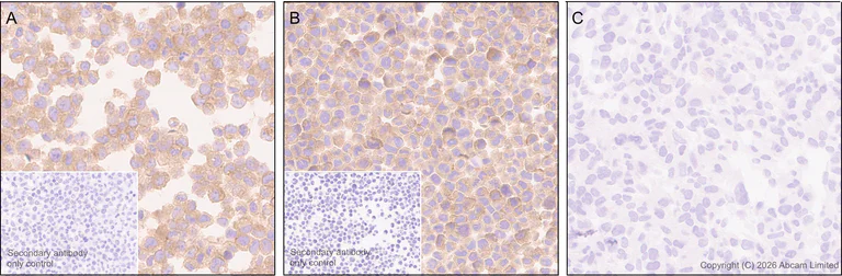Immunohistochemistry (Formalin/PFA-fixed paraffin-embedded sections) - Anti-CD2AP antibody [EPR30265-529] (AB325800)