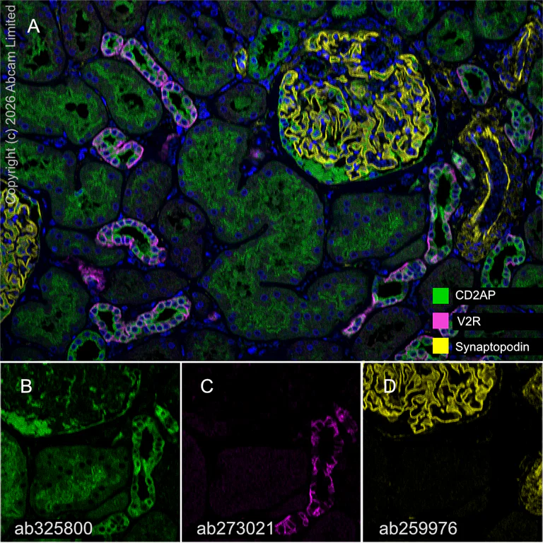 Multiplex immunohistochemistry - Anti-CD2AP antibody [EPR30265-529] (AB325800)