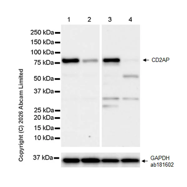 Western blot - Anti-CD2AP antibody [EPR30265-529] (AB325800)