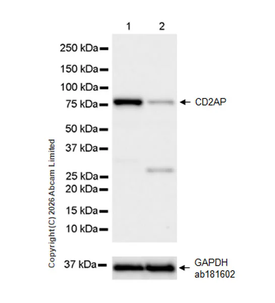 Western blot - Anti-CD2AP antibody [EPR30265-529] (AB325800)