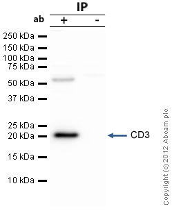 Immunoprecipitation - Anti-CD3 antibody (AB16044), expandable thumbnail