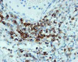 Immunohistochemistry (Formalin/PFA-fixed paraffin-embedded sections) - Anti-CD3 antibody (AB828)