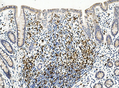 Immunohistochemistry (Formalin/PFA-fixed paraffin-embedded sections) - Anti-CD3 antibody (AB828), expandable thumbnail