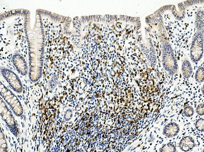 Immunohistochemistry (Formalin/PFA-fixed paraffin-embedded sections) - Anti-CD3 antibody (AB828)