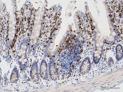 Immunohistochemistry (Formalin/PFA-fixed paraffin-embedded sections) - Anti-CD3 antibody (AB828), expandable thumbnail