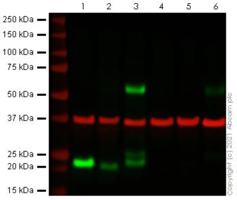 Western blot - Anti-CD3 antibody [CD3-12] (AB11089)