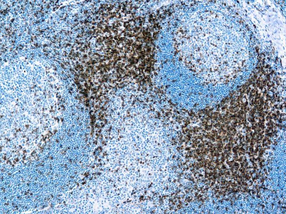 Immunohistochemistry (Formalin/PFA-fixed paraffin-embedded sections) - Anti-CD3 antibody [F7.2.38] (AB17143), expandable thumbnail