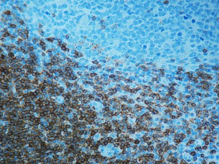 Immunohistochemistry (Formalin/PFA-fixed paraffin-embedded sections) - Anti-CD3 antibody [F7.2.38] (AB17143), expandable thumbnail