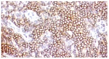 Immunohistochemistry (Frozen sections) - Anti-CD3 antibody [FN-18] (AB25109)