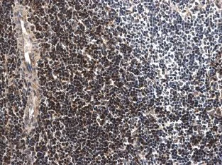 Immunohistochemistry (Formalin/PFA-fixed paraffin-embedded sections) - Anti-CD3 antibody [RM0027-3B19] (AB56313)