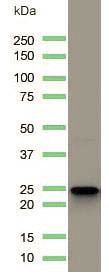 Western blot - Anti-CD3 antibody [SP162] (ab135372), expandable thumbnail