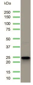 Western blot - Anti-CD3 antibody [SP162] (AB135372)