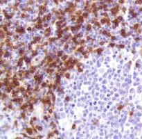 Immunohistochemistry (Formalin/PFA-fixed paraffin-embedded sections) - Anti-CD3 antibody [SP162] - Low endotoxin, Azide free (AB246799)