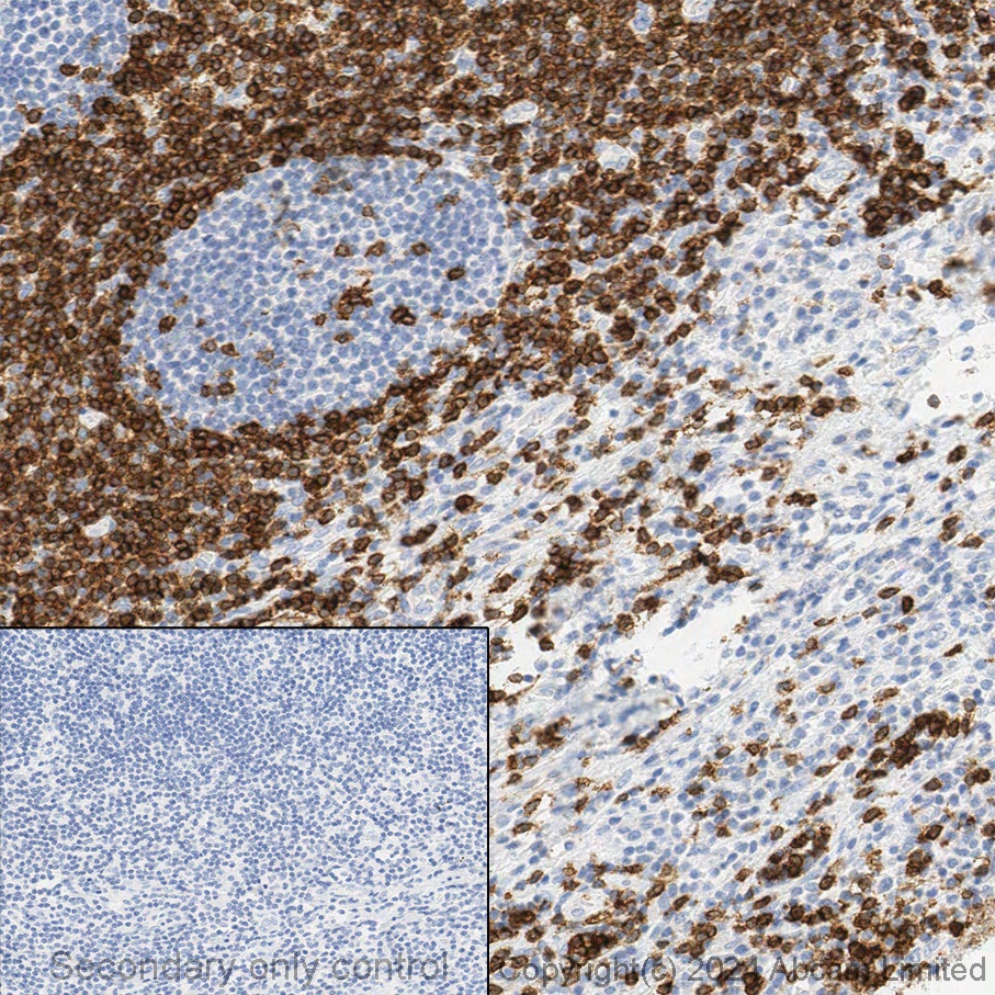 Immunohistochemistry (Formalin/PFA-fixed paraffin-embedded sections) - Anti-CD3 antibody [SP162] - Low endotoxin, Azide free (ab246799), expandable thumbnail