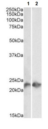 Western blot - Anti-CD3 antibody [UCH-T1] (AB215267), expandable thumbnail