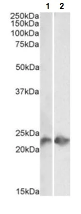 Western blot - Anti-CD3 antibody [UCH-T1] (AB215267)