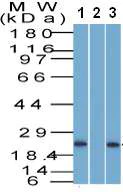 Western blot - Anti-CD3 epsilon antibody (AB187281)