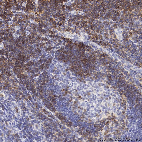 Immunohistochemistry (Formalin/PFA-fixed paraffin-embedded sections) - Anti-CD3 epsilon antibody (AB5690), expandable thumbnail