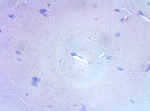 Immunohistochemistry (Formalin/PFA-fixed paraffin-embedded sections) - Anti-CD3 epsilon antibody (ab5690), expandable thumbnail