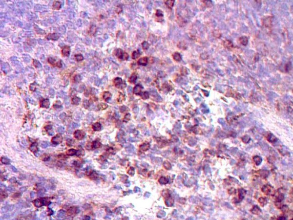 Immunohistochemistry (Formalin/PFA-fixed paraffin-embedded sections) - Anti-CD3 epsilon antibody (ab5690), expandable thumbnail