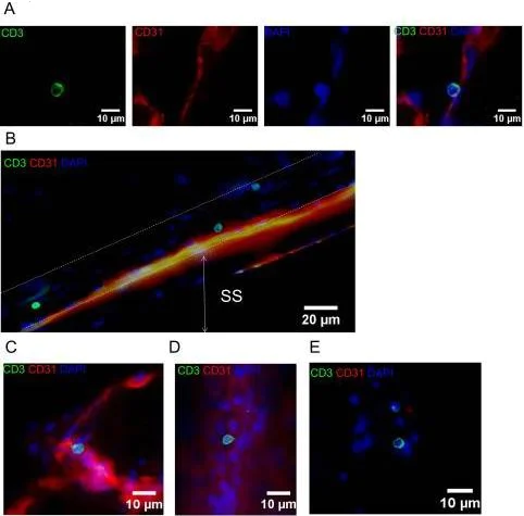 Immunohistochemistry (Formalin/PFA-fixed paraffin-embedded sections) - Anti-CD3 epsilon antibody (AB5690)