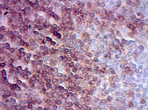 Immunohistochemistry (Formalin/PFA-fixed paraffin-embedded sections) - Anti-CD3 epsilon antibody (ab5690), expandable thumbnail