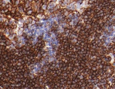 Immunohistochemistry (Formalin/PFA-fixed paraffin-embedded sections) - Anti-CD3 epsilon antibody (ab5690), expandable thumbnail